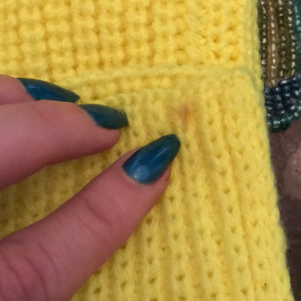 Neon Yellow Hand Warmers! - Picture 4 of 4